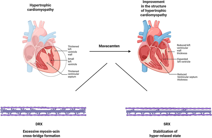 Figure 2. Cardiac Myosin Inhibitors in hypertrophic cardiomyopathy [3].